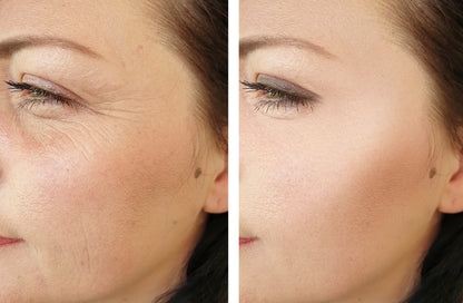 EELHOE Retinol Cream