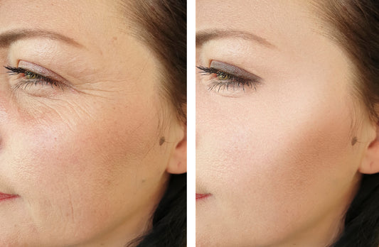 EELHOE Retinol Cream